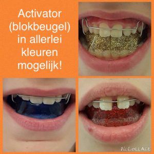 Orthodontie – Tandartsen –