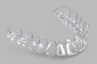 aligners